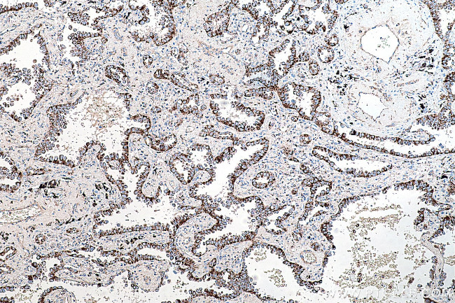 PCK2 Antibody in Immunohistochemistry (Paraffin) (IHC (P))