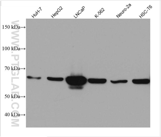 PCK2 Antibody in Western Blot (WB)