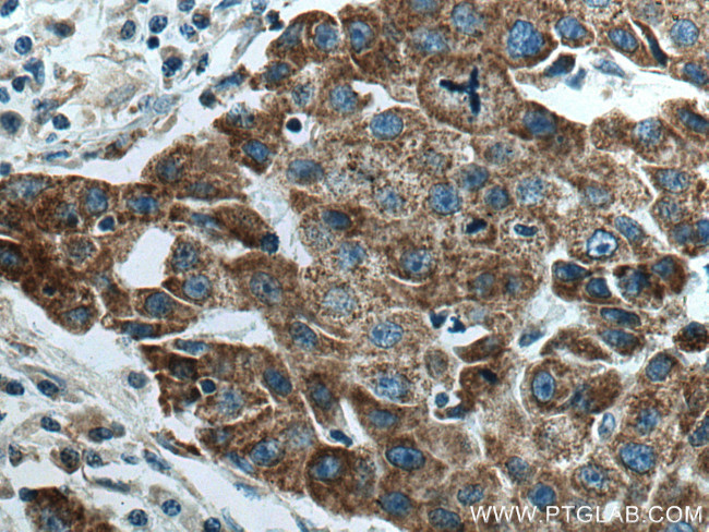 LRPPRC Antibody in Immunohistochemistry (Paraffin) (IHC (P))