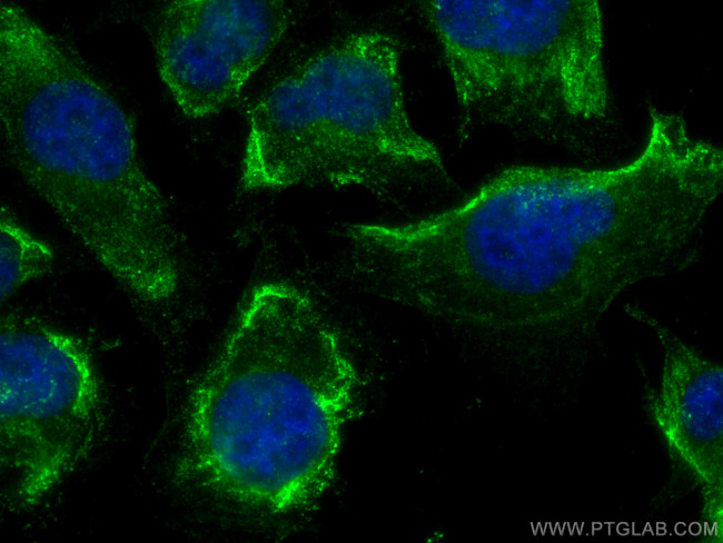 NOX4 Antibody in Immunocytochemistry (ICC/IF)