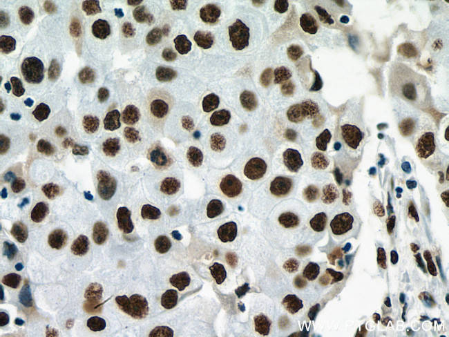 NF45 Antibody in Immunohistochemistry (Paraffin) (IHC (P))