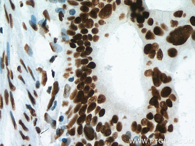 NF45 Antibody in Immunohistochemistry (Paraffin) (IHC (P))