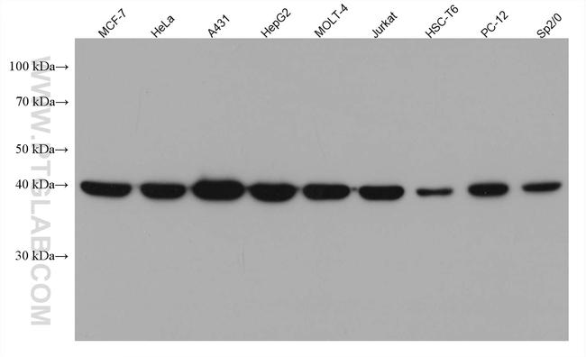 NF45 Antibody in Western Blot (WB)