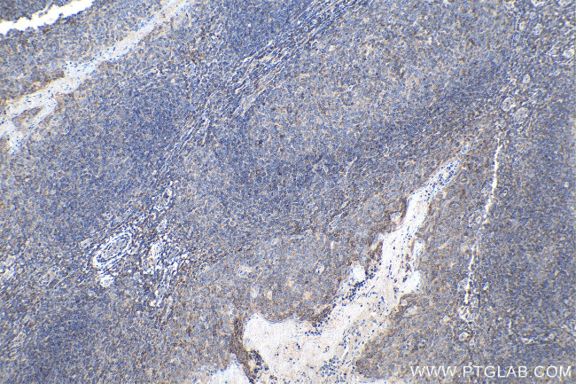 cyclin B1 Antibody in Immunohistochemistry (Paraffin) (IHC (P))