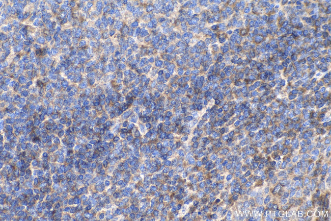 cyclin B1 Antibody in Immunohistochemistry (Paraffin) (IHC (P))