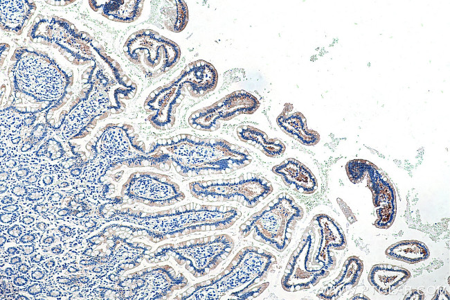 FABP2 Antibody in Immunohistochemistry (Paraffin) (IHC (P))