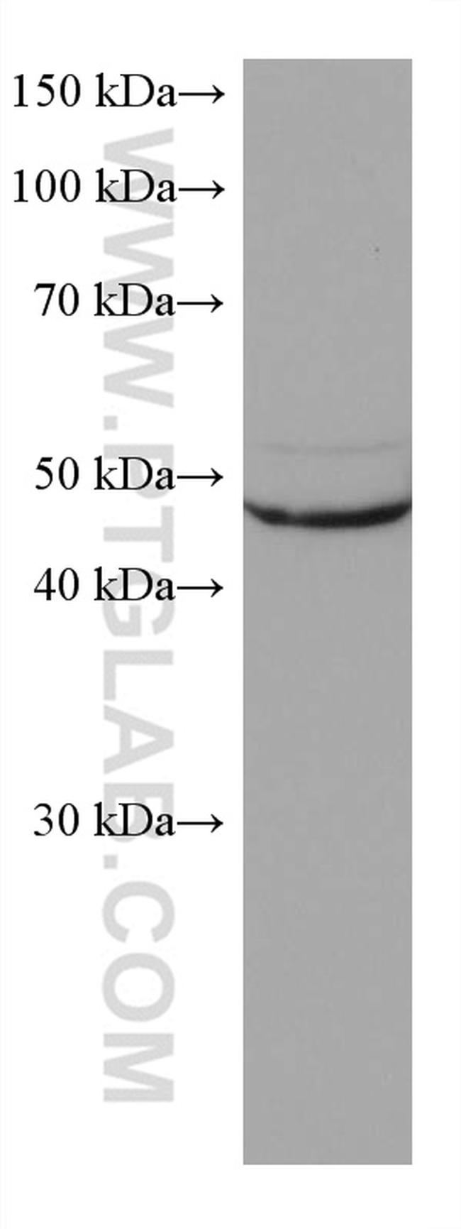 ASL Antibody in Western Blot (WB)