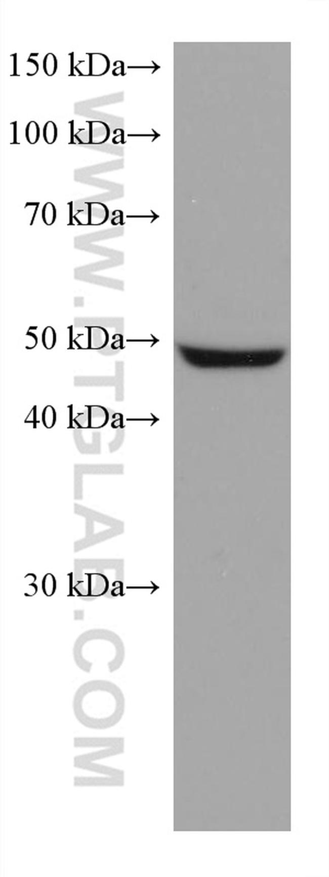 ASL Antibody in Western Blot (WB)