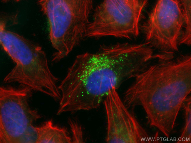 SNF8 Antibody in Immunocytochemistry (ICC/IF)