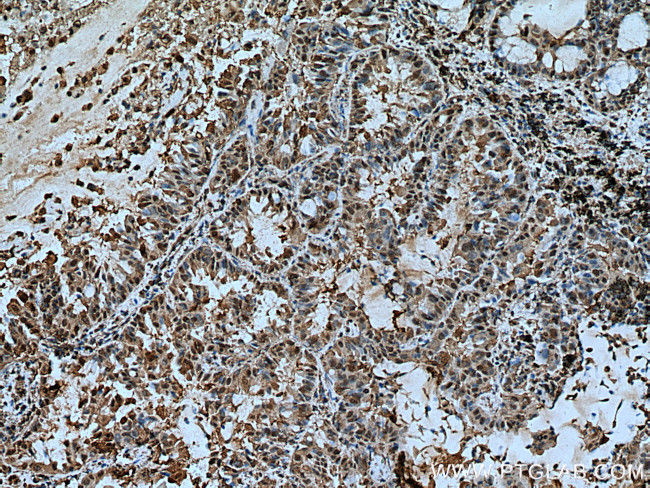 YWHAZ Antibody in Immunohistochemistry (Paraffin) (IHC (P))