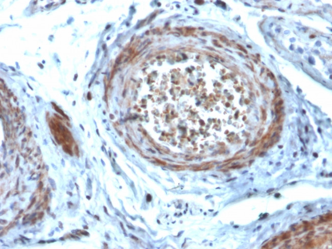 StAR (Steroidogenic Acute Regulator) (Leydig Cell Marker) Antibody in Immunohistochemistry (Paraffin) (IHC (P))