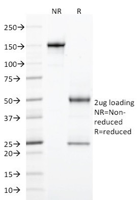 StAR (Steroidogenic Acute Regulator) (Leydig Cell Marker) Antibody in SDS-PAGE (SDS-PAGE)