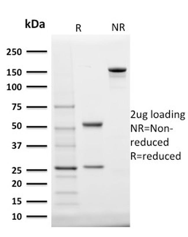 StAR (Steroidogenic Acute Regulator) Antibody in SDS-PAGE (SDS-PAGE)