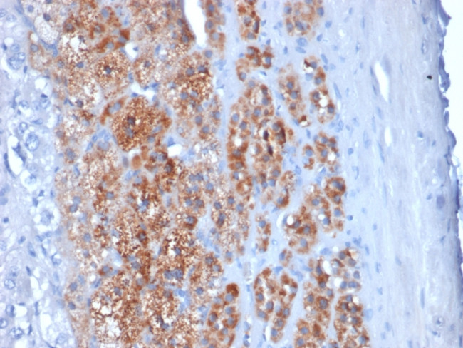 StAR (Steroidogenic Acute Regulator) Antibody in Immunohistochemistry (Paraffin) (IHC (P))