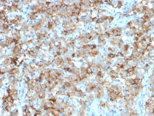 StAR (Steroidogenic Acute Regulator) Antibody in Immunohistochemistry (Paraffin) (IHC (P))