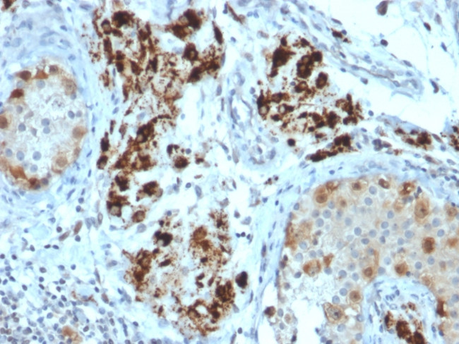 StAR (Steroidogenic Acute Regulator) Antibody in Immunohistochemistry (Paraffin) (IHC (P))