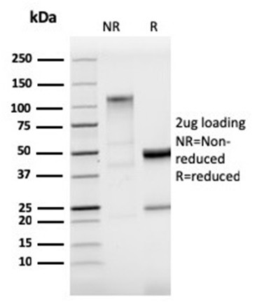 StAR (Steroidogenic Acute Regulator) (Leydig Cell Marker) Antibody in SDS-PAGE (SDS-PAGE)