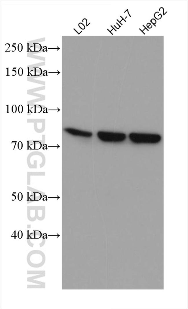 SLC6A12 Antibody in Western Blot (WB)