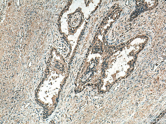 MAP3K7 Antibody in Immunohistochemistry (Paraffin) (IHC (P))