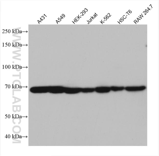 MAP3K7 Antibody in Western Blot (WB)