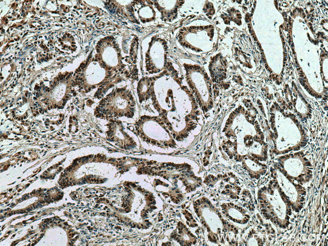 HNRNPK Antibody in Immunohistochemistry (Paraffin) (IHC (P))