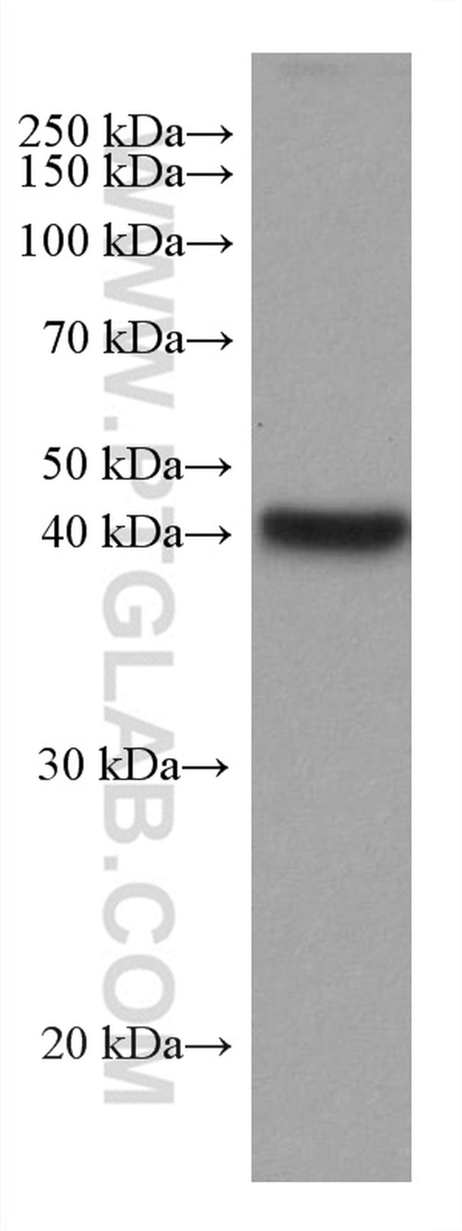 ADH6 Antibody in Western Blot (WB)