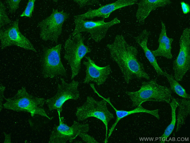 EPRS Antibody in Immunocytochemistry (ICC/IF)