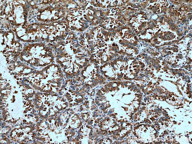 EPRS Antibody in Immunohistochemistry (Paraffin) (IHC (P))