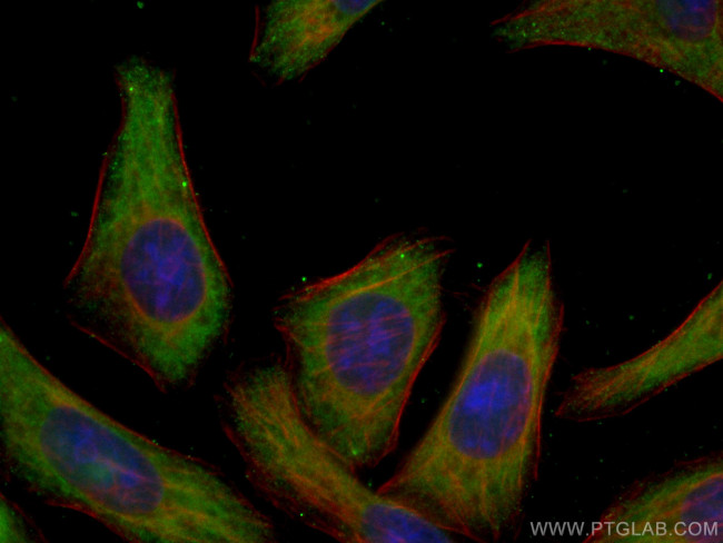 EIF3A Antibody in Immunocytochemistry (ICC/IF)