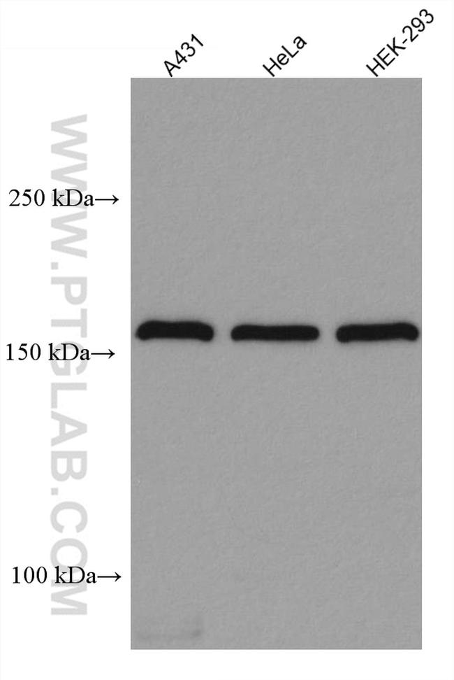 EIF3A Antibody in Western Blot (WB)