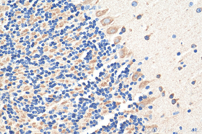 GRIN1 Antibody in Immunohistochemistry (Paraffin) (IHC (P))