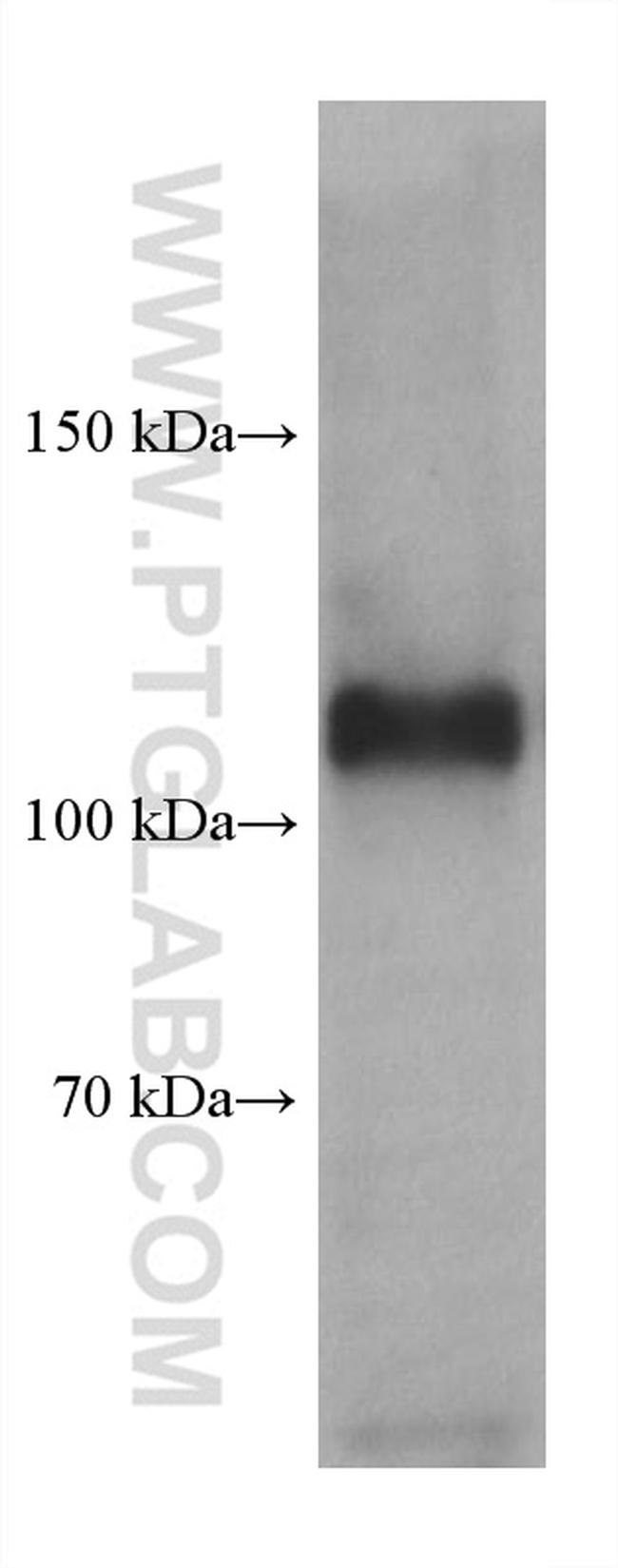 GRIN1 Antibody in Western Blot (WB)