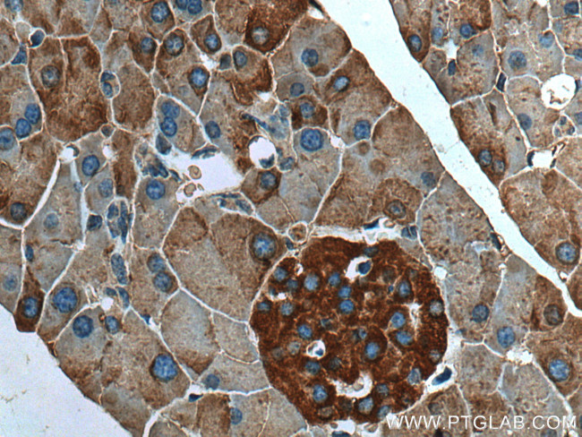 EIF3L Antibody in Immunohistochemistry (Paraffin) (IHC (P))