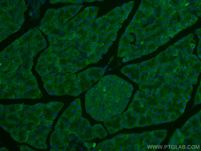 EIF3L Antibody in Immunohistochemistry (Paraffin) (IHC (P))