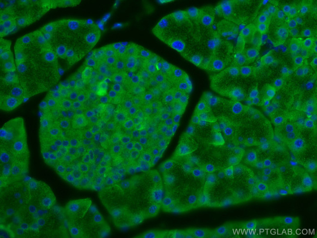 EIF3L Antibody in Immunohistochemistry (Paraffin) (IHC (P))