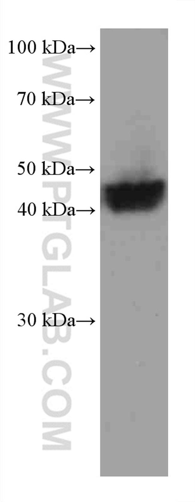 Nectin-4/PVRL4 Antibody in Western Blot (WB)