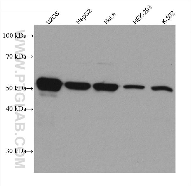 ILK Antibody in Western Blot (WB)