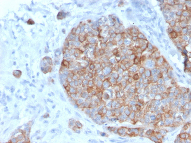 STAT2 Antibody in Immunohistochemistry (Paraffin) (IHC (P))