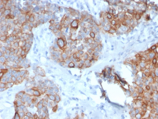 STAT2 Antibody in Immunohistochemistry (Paraffin) (IHC (P))