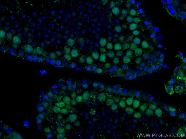 METTL3 Antibody in Immunohistochemistry (Paraffin) (IHC (P))