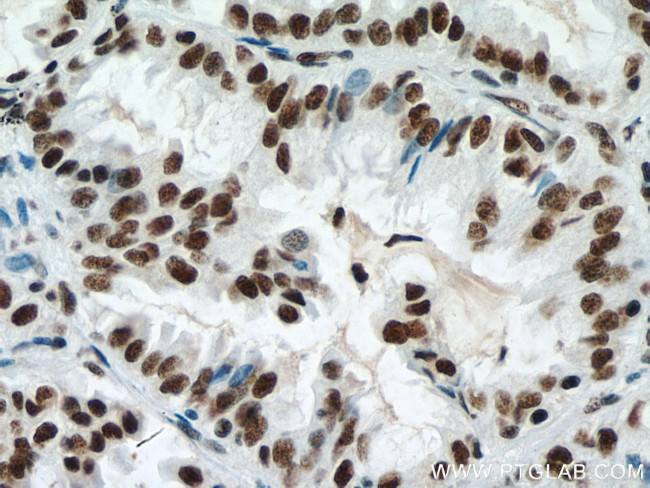 METTL3 Antibody in Immunohistochemistry (Paraffin) (IHC (P))