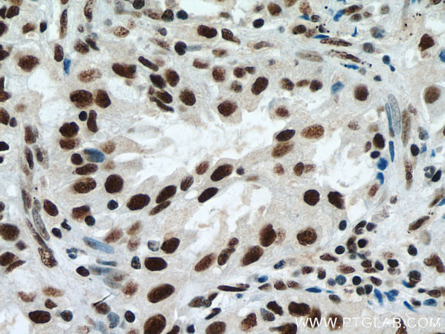 METTL3 Antibody in Immunohistochemistry (Paraffin) (IHC (P))