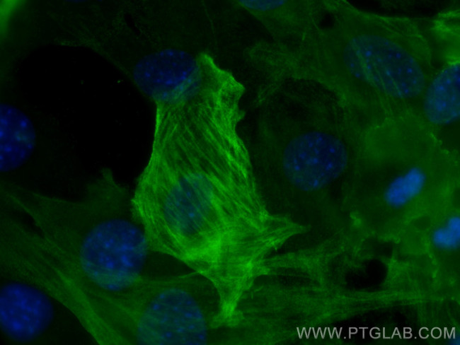 smooth muscle actin Antibody in Immunocytochemistry (ICC/IF)
