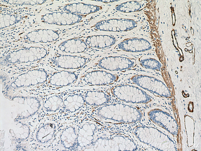 smooth muscle actin Antibody in Immunohistochemistry (Paraffin) (IHC (P))