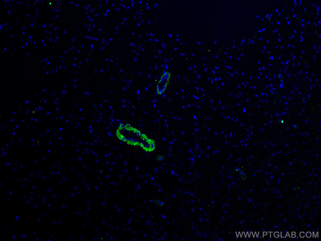 smooth muscle actin Antibody in Immunohistochemistry (Paraffin) (IHC (P))