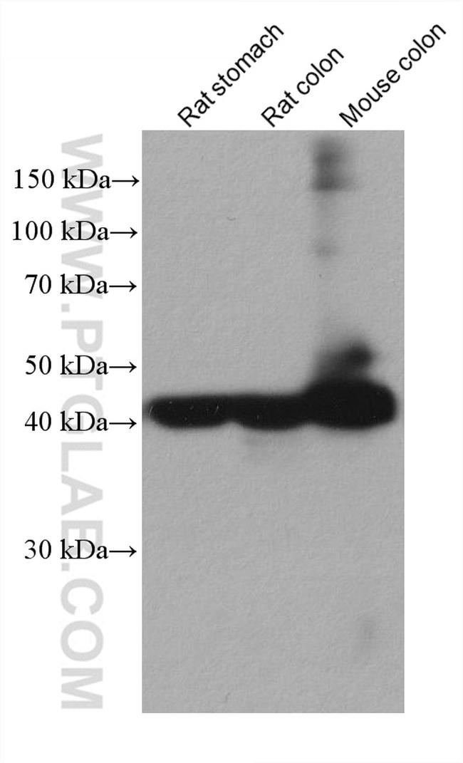 smooth muscle actin Antibody in Western Blot (WB)