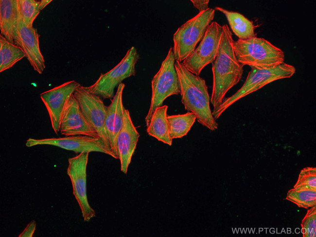 PTGES3 Antibody in Immunocytochemistry (ICC/IF)