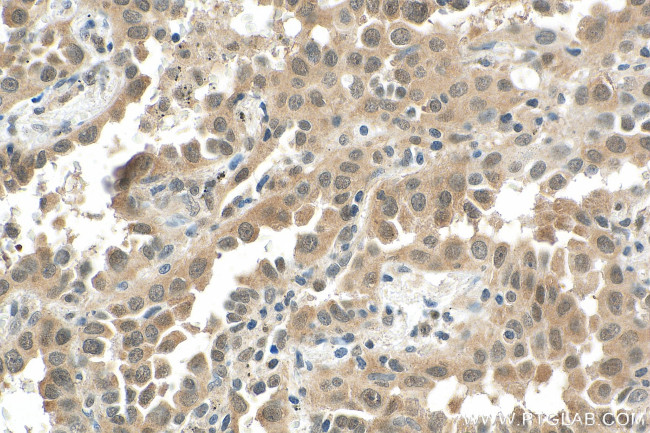 PTGES3 Antibody in Immunohistochemistry (Paraffin) (IHC (P))