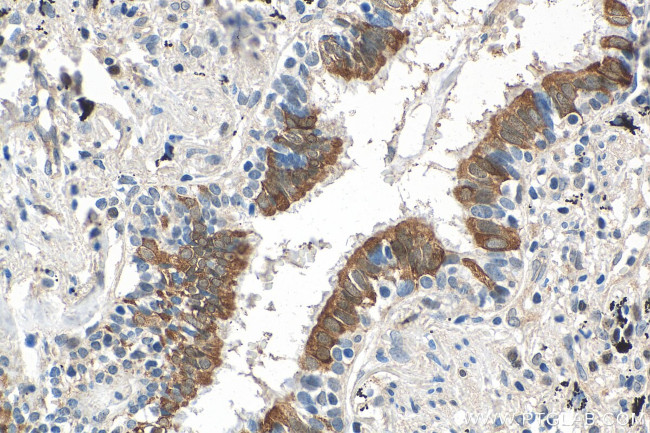 PTGES3 Antibody in Immunohistochemistry (Paraffin) (IHC (P))