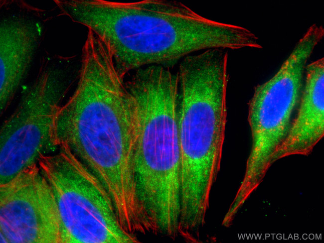 MARS Antibody in Immunocytochemistry (ICC/IF)